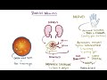 Diabetes mellitus (type 1, type 2) & diabetic ketoacidosis (DKA)