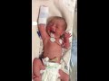 32 week preemie baby on day 2