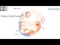 What causes blocked Salivary Glands? How is tumor ruled out?-Dr. Prakash Mahadevappa