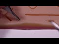 Running Subcutaneous Suture Technique