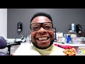 I GOT VENEERS DONE BY MEMPHIS DENTIST DR. PRICE
