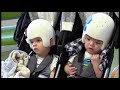 Heading Home: Previously Conjoined McDonald Twins Discharged