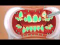 ASMR Changes in teerh when treated -tooth brace | setisfied dental  treatment 🪥#animatio#treatment