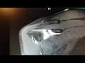 MRI Proof= Shoulder Reconstructive Surgery on Nov.8, 2017