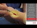 Suture Techniques Course Video