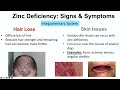 Zinc Deficiency Signs & Symptoms (ex. Hair Loss, Acne, Infections) & Why They Occur