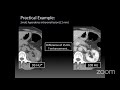 Imaging of Renal Masses [ALL YOU NEED TO KNOW] | Dr. Daniel J. Kowal (RadiologistHQ)