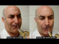 Фото трубачей с фиксированной челюстью | Постановка при игре на трубе | Евгений Алимов - труба