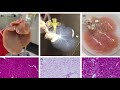 A Grape Made of... Meat?? - Tissue Recellularization