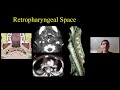 Head & Neck Spaces Made Simple, Dr. Suresh Mukherji, Medality (MRI Online) Radiology Noon Conference