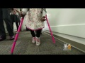 Surgery Helps Children With Cerebral Palsy Walk