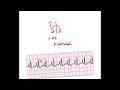 CCRN review 2024 - ECG changes in Right Atrial enlargement #trending #ecg #ccrn #nclex #trending