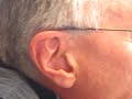 Petes' ear circle