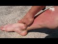 Shin Conditioning: a Progressive Workout for Strengthening your Shins | Martial Arts Explained