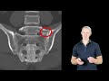 Dr Paul Mason on back pain - part 2 - science based treatments often ignored by doctors and physios