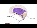 2-Minute Neuroscience: Hydrocephalus