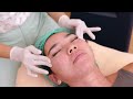 Sylfirm X Treatment at Puriva Clinic Bali | Skin Tightening, Acne Scar Reduction, Melasma Treatment