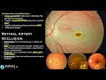 Ultra High-Yield Ophthalmology Review for Students [USMLE Step 1, Step 2 CK, Clerkship]