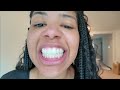 Vlog: Ancestry Results, Byte Aligners, Amazon Haul | Vlog