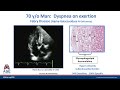 HCM Microlesson Case Example #4: The Walls of the Heart are Thick – Case of Fabry’s Disease