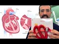 Watchman Device for AFib: Procedure Details, How It Works, and More.