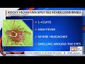 Rocky Mountain Spotted Fever confirmed in Champaign County