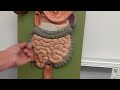 Digestive Tract Anatomy | Review and Practice