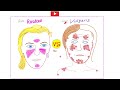 Acne Vulgaris - Propionibacterium acnes - Acne Treatment - Microbiology  & Infectious Diseases