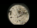 Dirty water under microscope||
