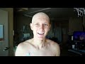 My Cancer Journey: Shaving head and heading home - Episode 17