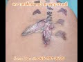 ลบรอยสัก /tattooremove