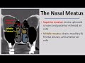 Imaging Anatomy of the Paranasal Sinuses