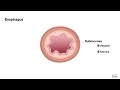 HCC 1475.1-Esophagus-Anatomy