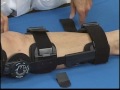 T-Scope Post Op Knee Brace Application