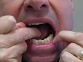 The One Minute Flossing Technique
