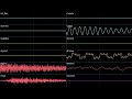 Metal 3 - Pikmin 2 (High Quality + Oscilloscope)