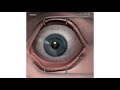 How LASIK Eye Surgery Is Performed