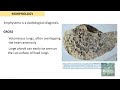 Chronic Obstructive Pulmonary Disease Part 1: Emphysema- Pathology