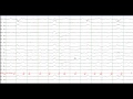 Status Epilepticus