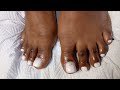 White Acrylic Toes #nails #SouthAfricannailTech #pedicure #LeesNails
