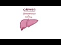 Cirrhosis Overview | Clinical Presentation