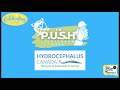 P.U.S.H. Livestream Promotion- World Spina Bifida and Hydrocephalus Day