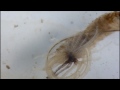 Rat Tailed Maggot with Parasite attached to Anus