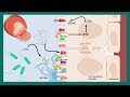 Hydrocephalus | What can cause hydrocephalus? | Communicating vs non communicating hydrocephalus