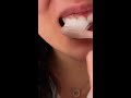 Dentist/Orthodontist Explains Bleeding Gums & What To Do About Gingivitis