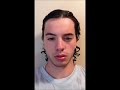 One Year Of Hair Growth In One Minute