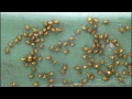 Garden Orb Weaver Spiderlings  Music by Quatre Pieces Collees ( part 2 )
