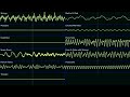 World Map - Pikmin 2 (High Quality + Oscilloscope)