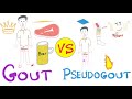 Gout VS Pseudogout