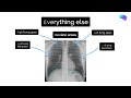 Chest X-ray Interpretation | How to Read a CXR | OSCE Guide | UKMLA | CPSA